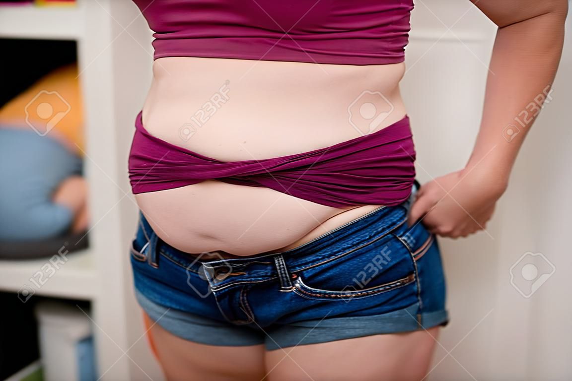 배꼽 지방을 꼬집는 여자의 근접 촬영입니다. 그녀의 복부를 꼬집는 파란색 반바지에 젊은 슬림 여자. 다이어트와 체중 감량 개념입니다.