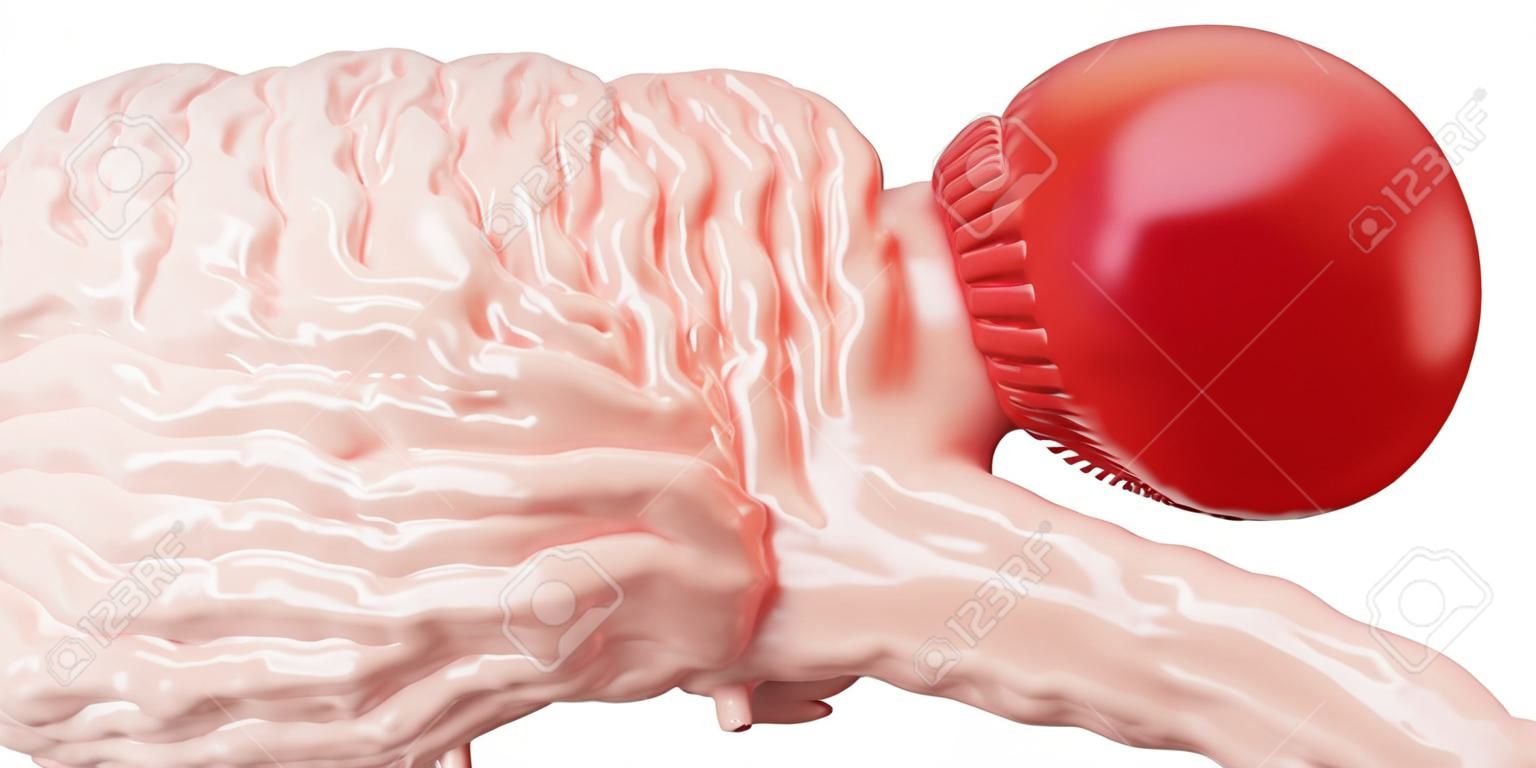 Mózg szkoda od bokserskiego pojęcia, 3D rendering