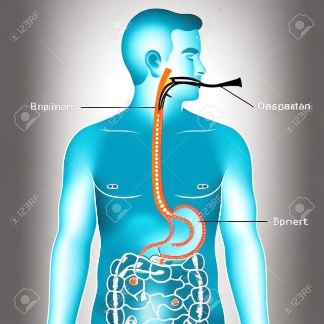Schemat intubacji nosowo-żołądkowej, schematyczna ilustracja wektorowa, ilustracja edukacyjna nauk medycznych