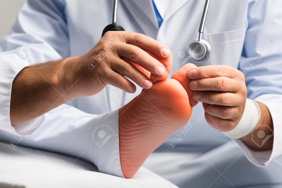 Arzt Hautarzt untersucht den Fuß auf das Vorhandensein von Fußpilz