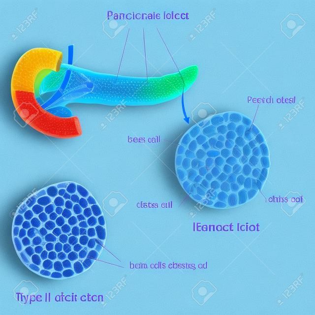 Pancreatic islet normal and type 1 diabetic 