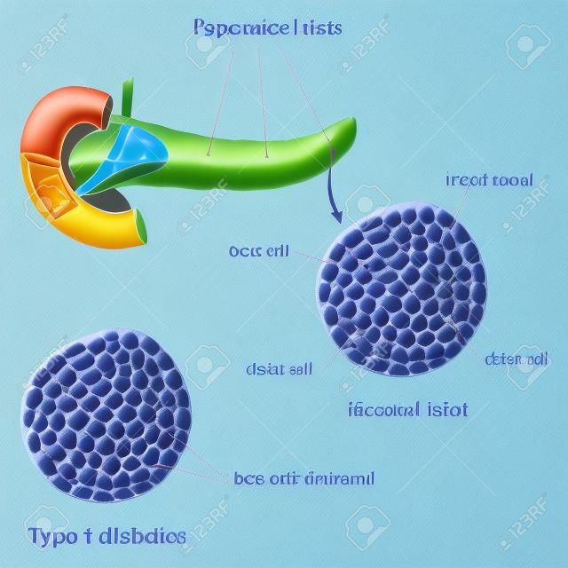 Pancreatic islet normal and type 1 diabetic 