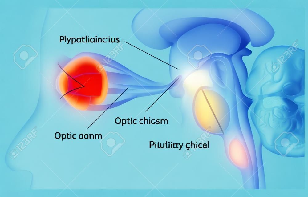 Glándula pituitaria y el quiasma óptico