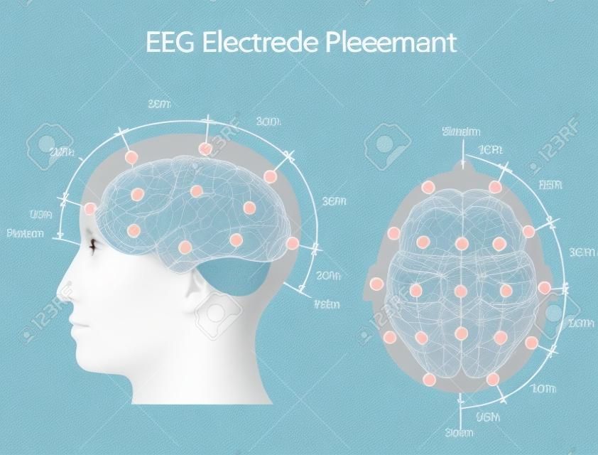 Colocación de los electrodos EEG