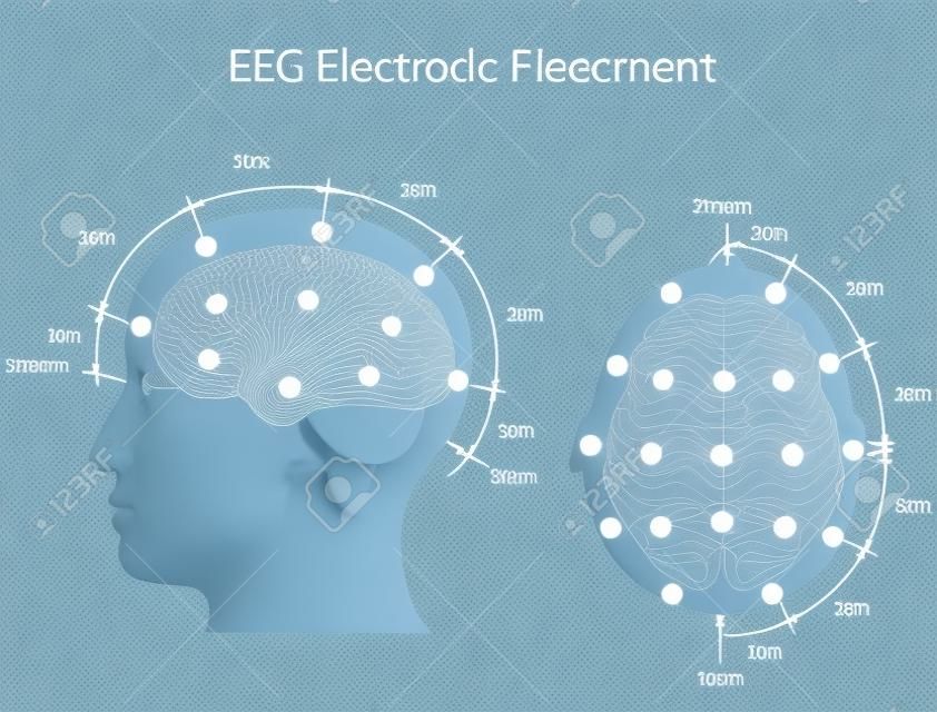 EEG umieszczenie elektrody