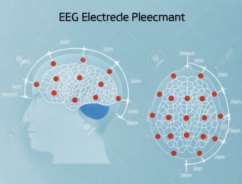 Colocación de los electrodos EEG