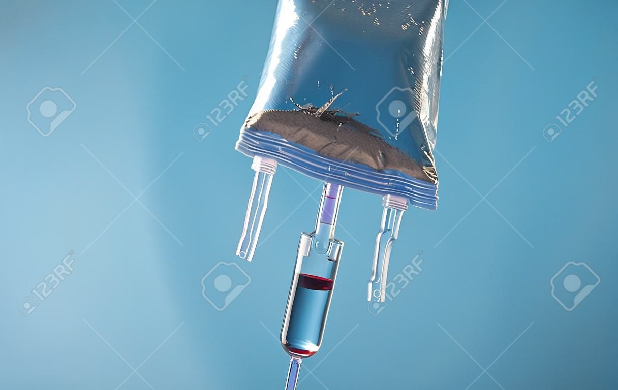 Infusion bag in the blue background. IV drip chamber