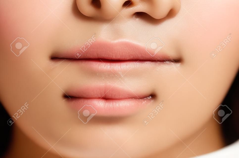 Acne or pimple obstruction on chin and face of asian thai women