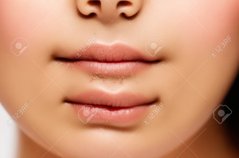 痤瘡或疙瘩阻塞在亞裔泰國婦女的下巴和臉上