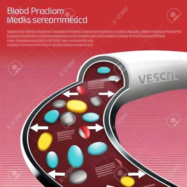 Beautiful vector illustration of blood pressure infographic. Abstract medicine concept. Useful for poster, indographics, placard, leaflet, brochure, print, book and advertisement graphic design.