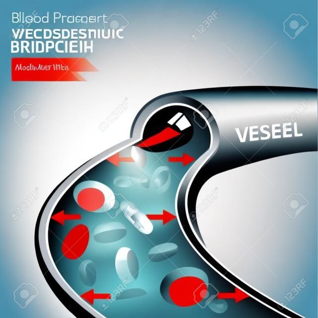 Beautiful vector illustration of blood pressure infographic. Abstract medicine concept. Useful for poster, indographics, placard, leaflet, brochure, print, book and advertisement graphic design.