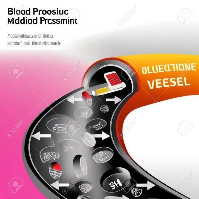 Bella illustrazione vettoriale di infografica pressione sanguigna. Concetto astratto medicina. Utile per poster, indographics, cartello, depliant, brochure, stampa, libri e pubblicità graphic design.