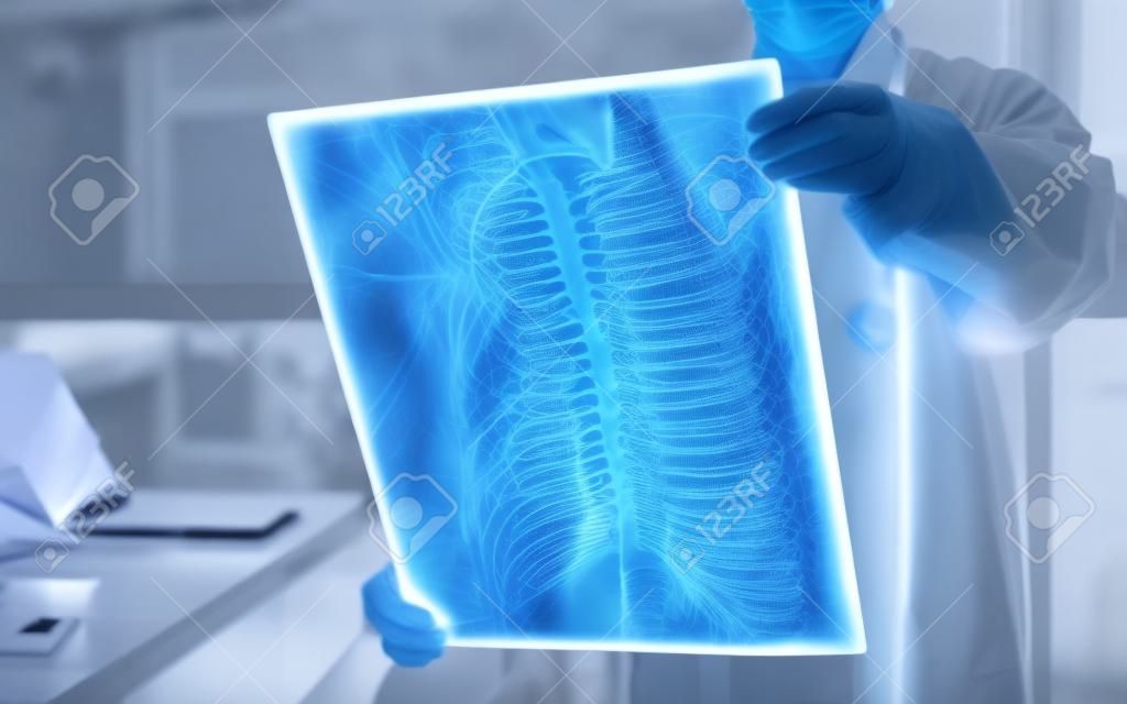 Médico quirúrgico mirando la película radiológica de rayos X de la columna vertebral para el diagnóstico médico sobre la salud del paciente en la enfermedad de la columna vertebral, la enfermedad del cáncer de huesos, la atrofia muscular espinal, el concepto de atención médica