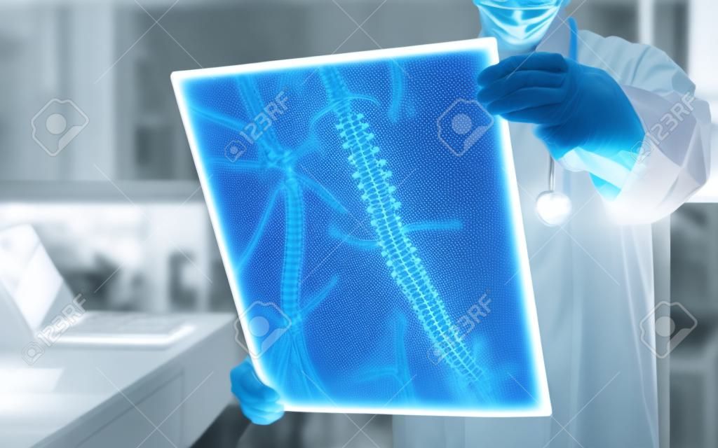 Medico chirurgo che esamina pellicola radiografica spinale radiologica per diagnosi medica sulla salute del paziente sulla malattia della colonna vertebrale, malattia del cancro osseo, atrofia muscolare spinale, concetto di assistenza medica