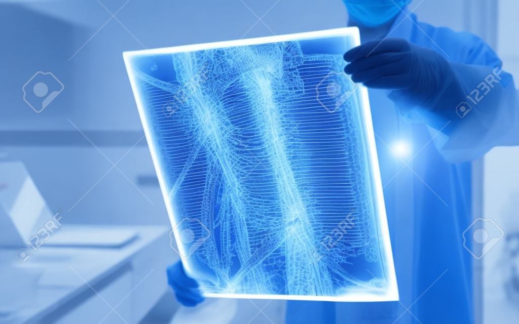 Chirurgischer Arzt, der radiologische Röntgenfilme der Wirbelsäule zur medizinischen Diagnose der Gesundheit des Patienten bei Wirbelsäulenerkrankungen, Knochenkrebserkrankungen, spinaler Muskelatrophie, medizinischem Gesundheitskonzept betrachtet