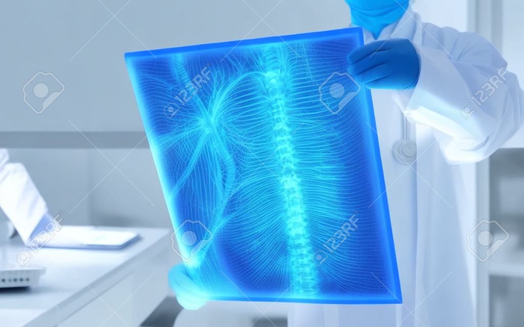 Médico quirúrgico mirando la película radiológica de rayos X de la columna vertebral para el diagnóstico médico sobre la salud del paciente en la enfermedad de la columna vertebral, la enfermedad del cáncer de huesos, la atrofia muscular espinal, el concepto de atención médica