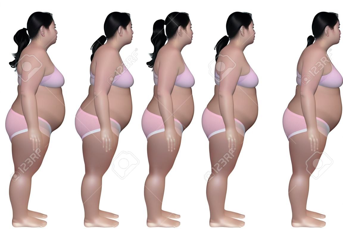 一個肥胖的女人的側視圖