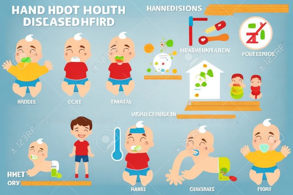 Bambini HFMD contagiati. Dettaglio del poster dell'infografica sulla malattia della mano-piede-bocca con prevenzione e trattamento dei sintomi. illustrazione vettoriale del concetto di salute dei cartoni animati.