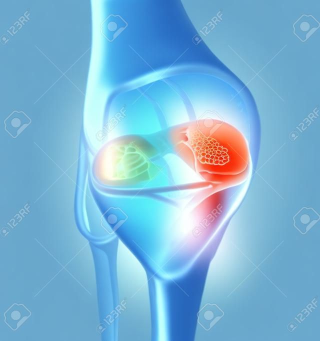 투명한 대퇴골과 관절낭, 반월상 연골 및 인대가 있는 무릎 관절을 보여주는 3d 그림