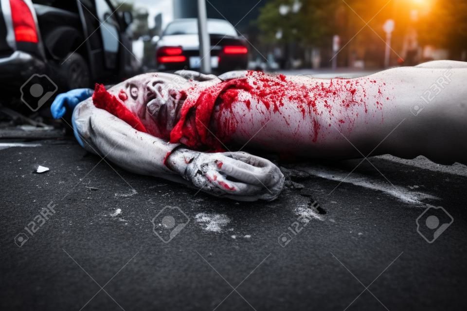 Blutungen Mann auf der Straße nach Autounfall liegen