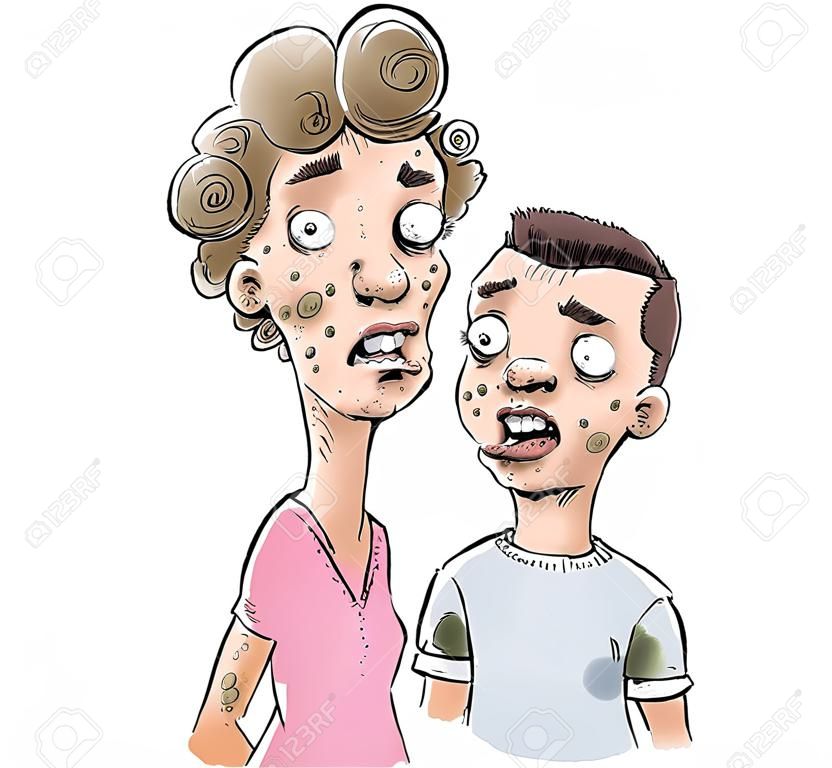 Een tekenfilm tiener meisje en jongen met ernstige acne.