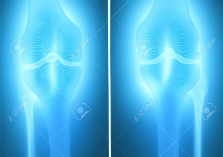película de rayos x de la rodilla