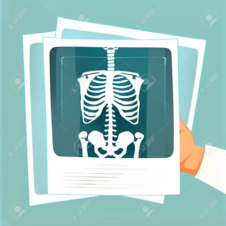 X ray medical roentgen human body skeleton diagnostic image in male doctor hand vector flat