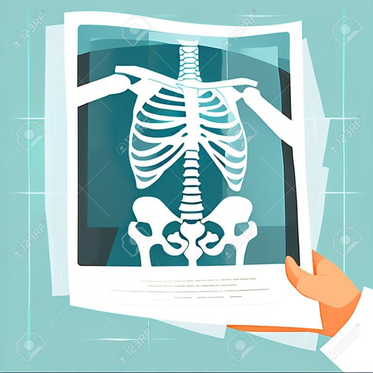 X ray medical roentgen human body skeleton diagnostic image in male doctor hand vector flat