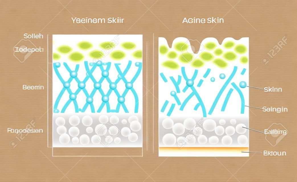 젊은 피부와 노화 피부. 엘라스틴과 콜라겐. 나이가 피부에있는 콜라겐의 감소 및 깨진 엘라스틴을 보여주는 젊은 피부와 피부 노화의 다이어그램.
