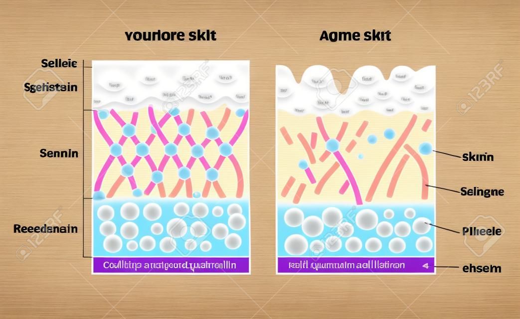 younger skin and aging skin. elastin and collagen. A diagram of younger skin and aging skin showing the decrease in collagen and broken elastin in older skin.
