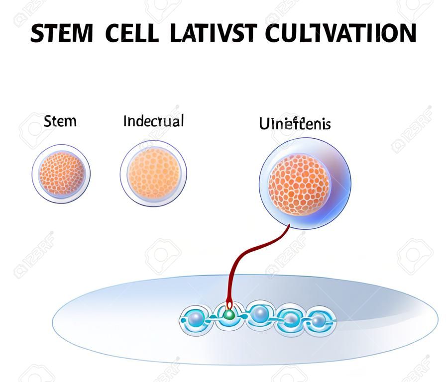 Stammzellkultivierung. Künstliche Befruchtung der Eizelle durch ein Spermium außerhalb des Körpers. Nach einigen Tagen entwickeln sie in undifferenzierten Stammzellen.