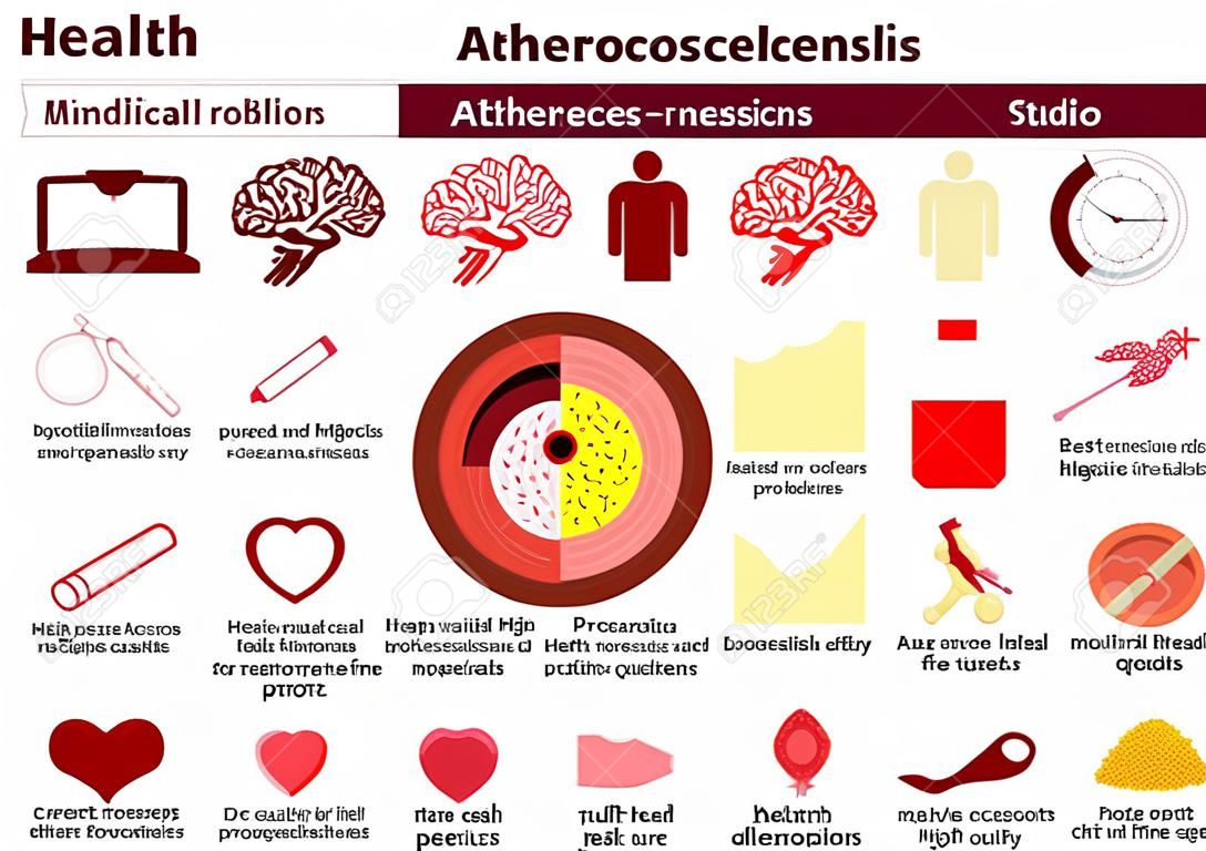 Атеросклероз. проблемы со здоровьем. медицина в медицинских инфографики. элементы и иконки для дизайна. Концепция.
