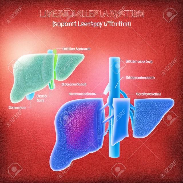 Trasplante de hígado. Anatomía segmentaria del hígado y suministro de sangre. Anatomía humana