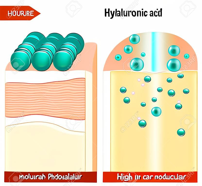 Acide hyaluronique. L'acide hyaluronique dans les produits de soins de la peau. Faible masse moléculaire et haut moléculaire. Différence