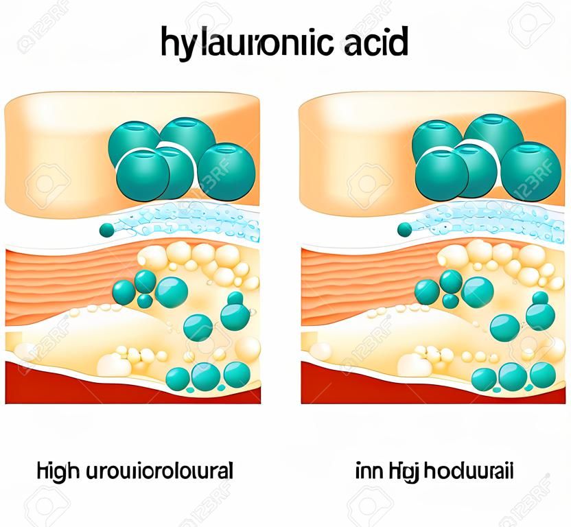 Ácido hialurônico. Ácido hialurônico em produtos de cuidados com a pele. Baixo molecular e alto molecular. Diferença