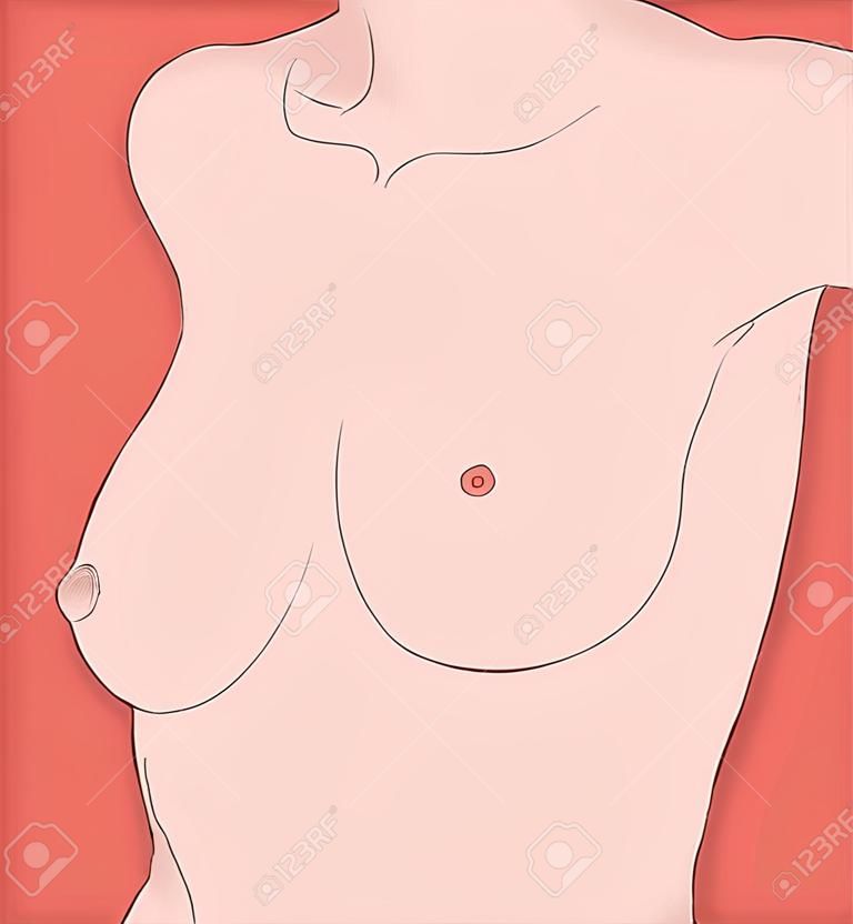 female torso