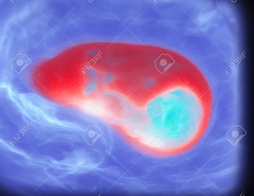 Ultraschall des Fötus 3 Monate in der Gebärmutter