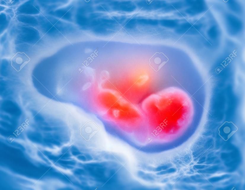 ecografía del feto de 3 meses en el vientre materno