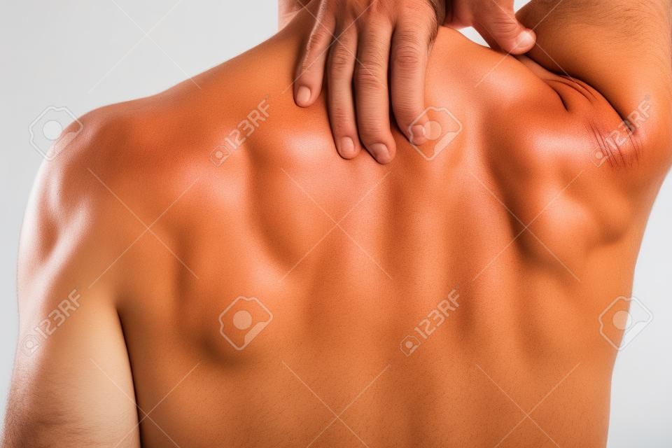 erupción cutánea de alergia en la espalda del hombre aislado en blanco