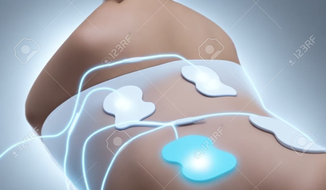 Corpo di donna con elettrodi sulla schiena. Stimolazione muscolare elettrica.