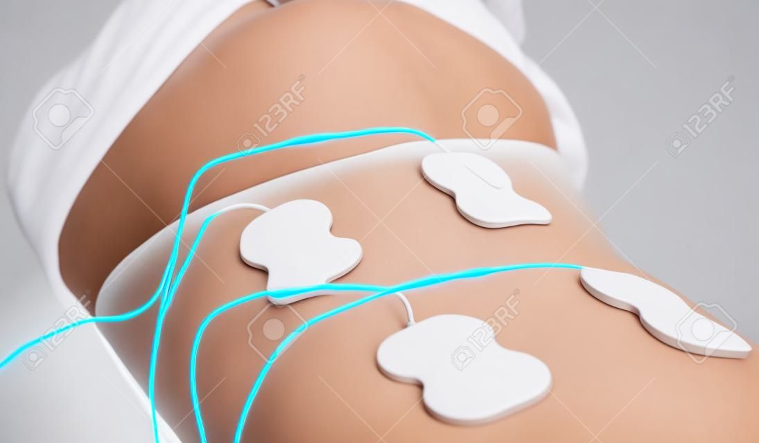 Woman body with electrodes on her back. Electrical muscle stimulation.