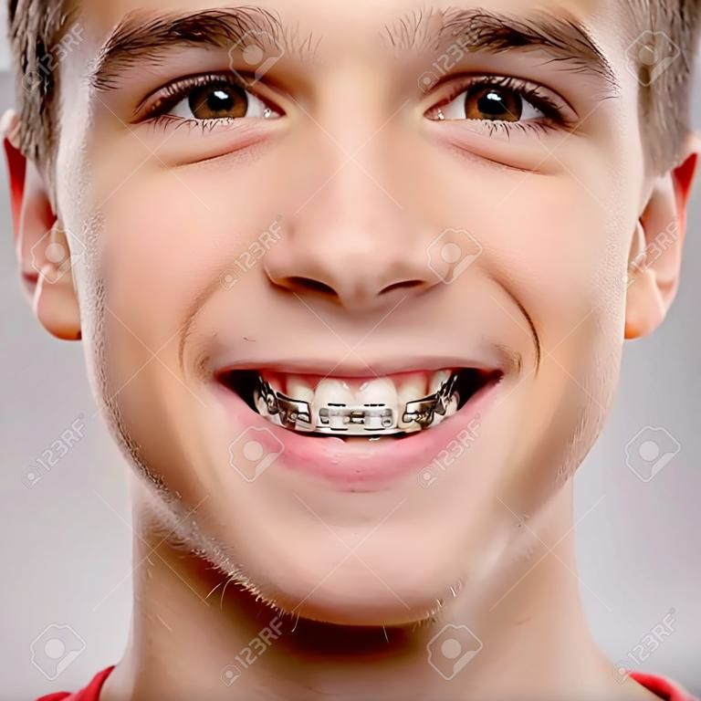 Lachende tiener jongen met beugel op zijn tanden. Close-up portret van een mooie jonge jongen met zelfs gezonde tanden.