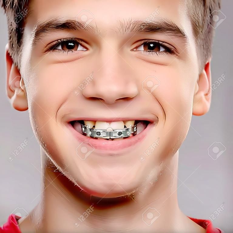 Muchacho adolescente sonriente con tirantes en los dientes. Retrato de primer plano de un hermoso joven con dientes incluso sanos.