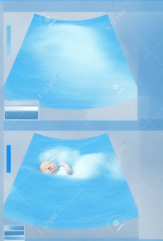Ultrasonido bebé