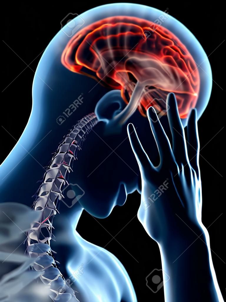 3D-Darstellung eines Mannes mit Kopfschmerzen