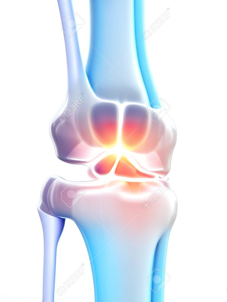 3d rendered medically accurate illustration of the knee joint showing pain