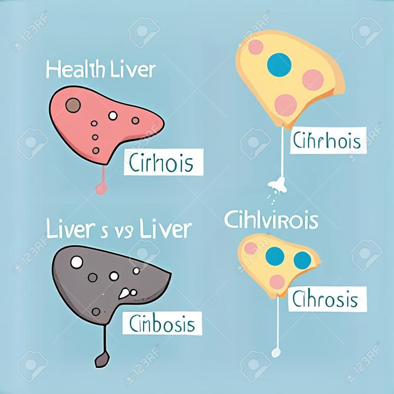 Health liver vs cirrhosis liver, great for health care concept