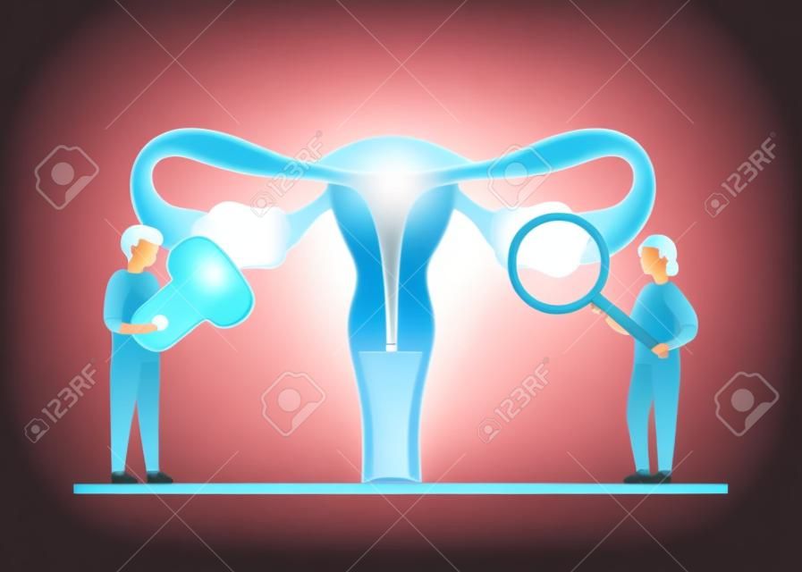 Dokter controle reproductieve systeem van de vrouw. Gezondheid en ziekte baarmoeder en eierstok interne orgaan. Polycysteus ovarium syndroom, ontsteking, pijn. Vector