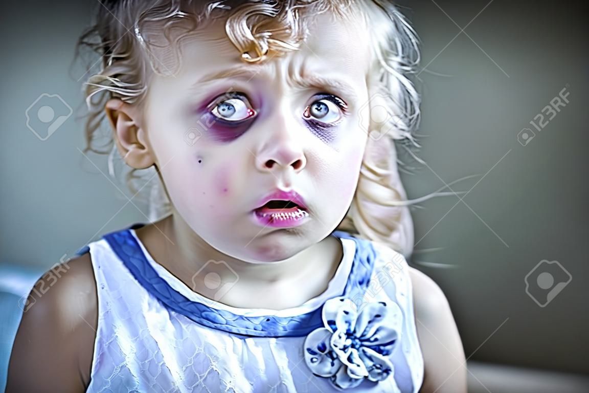 Traurig und ängstlich kleines Mädchen mit blutunterlaufenen Augen und zerschlagen.
