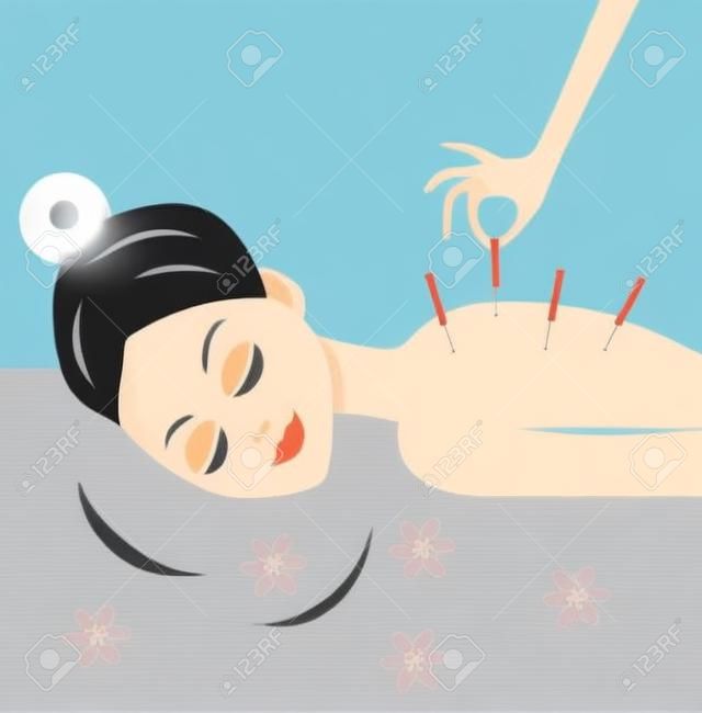 young woman accept procedure acupuncture, vector illustration